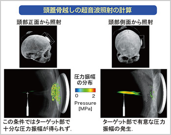 三次元的に人体の全身モデルを構築して生体内で起こる現象を理解し、医療に役立てる