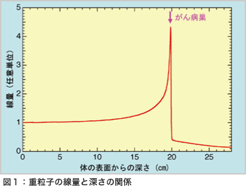 重粒子線治療シミュレーション