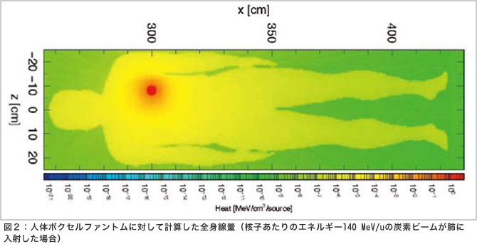 重粒子線治療シミュレーション