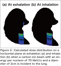 Simulation for Charged Particle Therapy