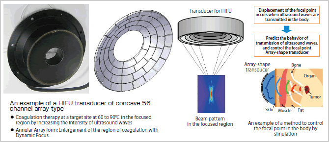 An example of a HIFU transducer of concave 56 channel array type