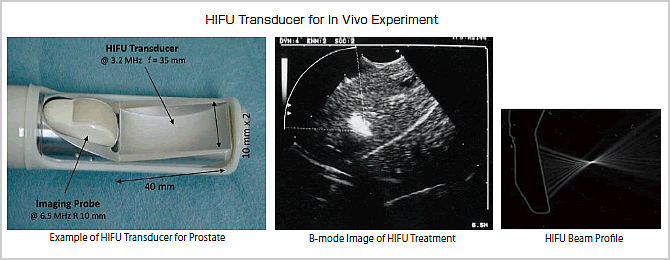 HIFU Transducer for In Vivo Experiment