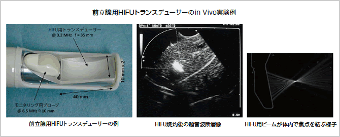 前立腺用HIFUトランスデューサーのin Vivo実験例