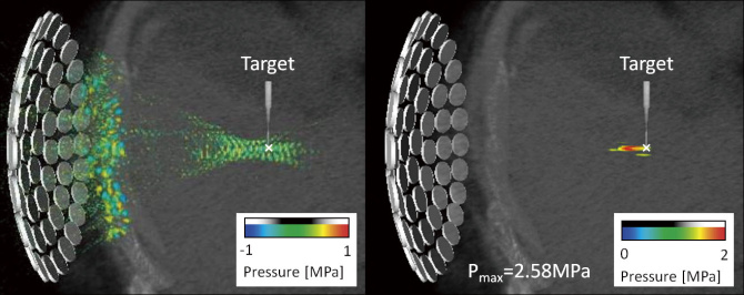 Figure 2 : Condition of ultrasound transmission